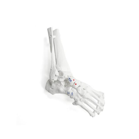 Modelo de Pie Equinovaro